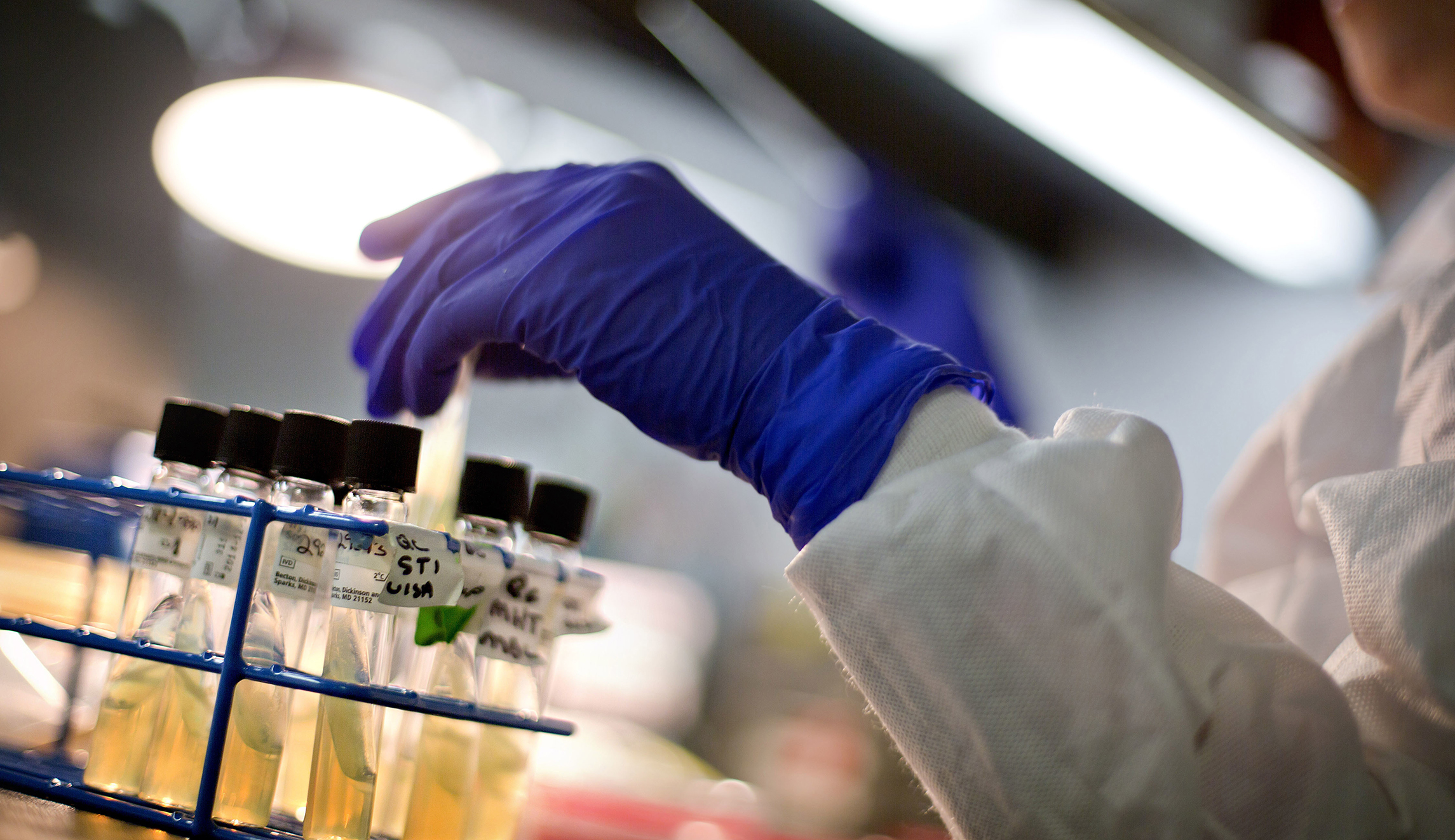 CDC finds ‘nightmare bacteria’ prevalent in US