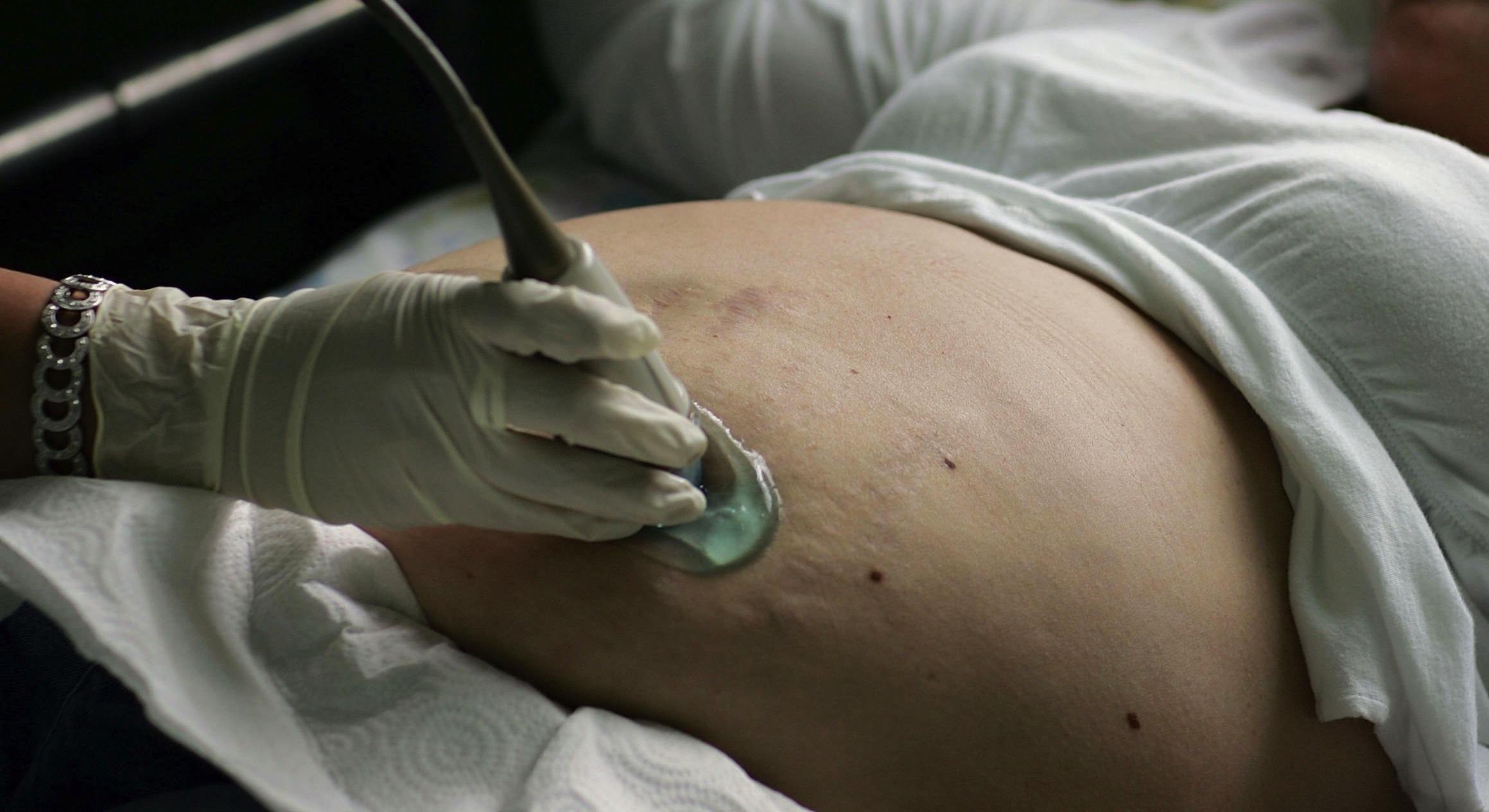 For all the claims about late-pregnancy abortions, there’s little data