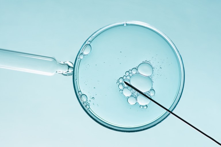 The tensions underlying AI and IVF