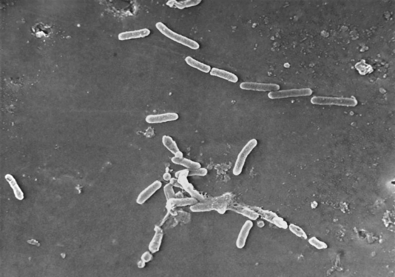 Nearly 40 million likely to die by 2050 from antimicrobially resistant infections