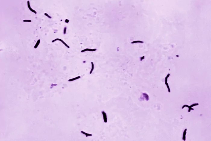 This 1966 microscope photo shows Mycobacterium tuberculosis bacilli, the organism responsible for causing the disease tuberculosis.